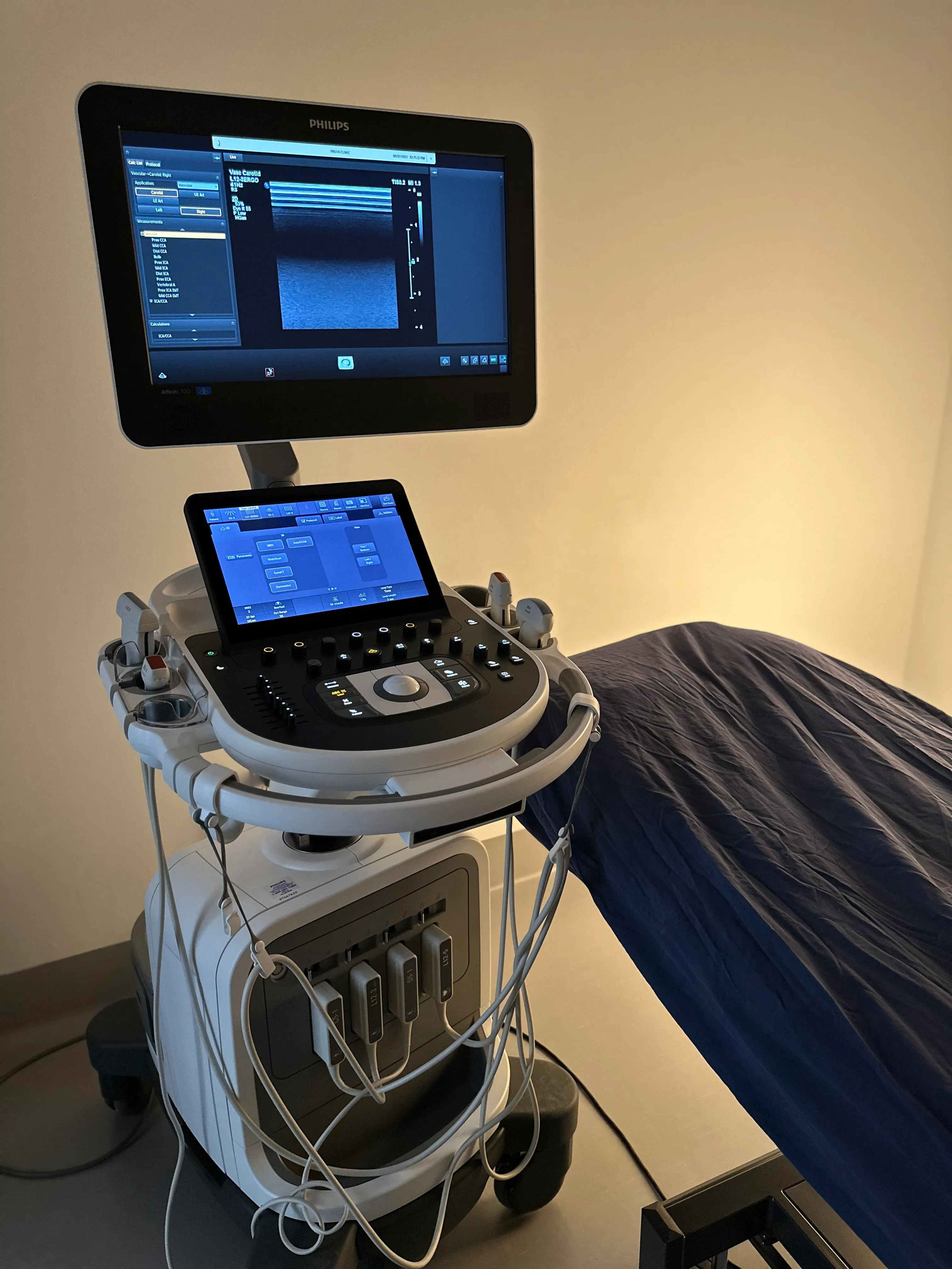 A photo of a modern echocardiogram machine beside an examination table.